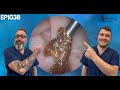 Satisfying Ear Wax & Skin Removals - EP1038