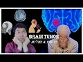 Brain tumors: Myths and Facts by Dr Skanda (Neurosurgeon) | Glioma | Meningioma | Schwannoma