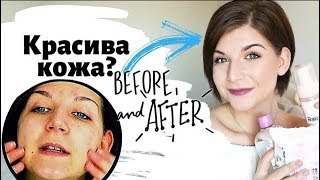 КАКВО стана с кожата ми???