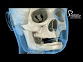 Mandibular Jaw, bone recession after losing teeth. Medically accurate dental 3D animation