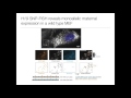 visualizing allele specific expression in single cells reveals epigenetic mosaicism