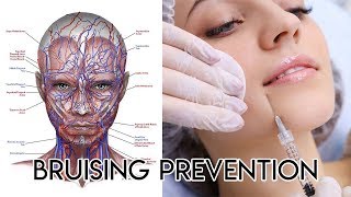 Bruising Prevention