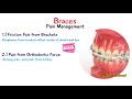 how to deal with braces discomfort causes first day pain braces pain and how to manage