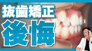 【矯正】犬歯が出てると抜歯確定？口元下がるってホント？【審美歯科 歯列矯正 歯並び 歯医者 eライン】