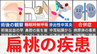 【4分で解説、9分で国試問題】扁桃炎や扁桃肥大について解説