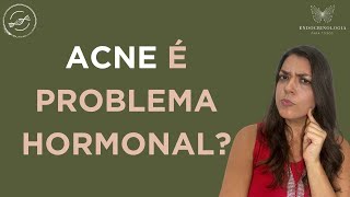 Toda acne é hormonal?