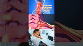 w work related neck pain/കഴുത്ത് വേദന ഉണ്ടാകാറുണ്ടോ? #youtubeshorts #shots #shortvideo #neckpain