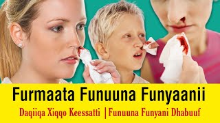 Furmaata Funuuna Funyaanii |Akkata Dhiiga Funyaanii itti Dhaaban