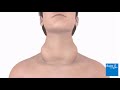 how a thyroid gland can become underactive bupa health