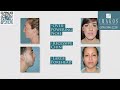 how rhinoplasty and chin implants create a perfect profile