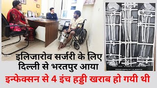 Tibia fibula fracture infection Ilizarov surgery ke  liye delhi se aaya patient #ilizarovsurgery