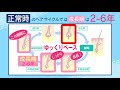 aga説明ビデオ２agaのメカニズム：ヘアーサイクルとの関係