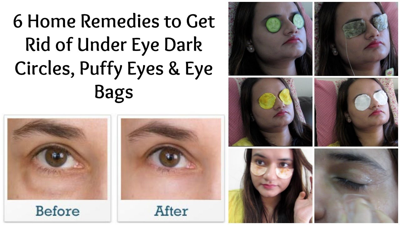 Home Remedies For Puffy Eyes Bags Under Eyes Home Home Remedies For Puffy Eyes Bags Under Eyes Home