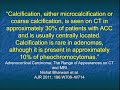 ct evaluation of primary adrenocortical carcinoma part 1