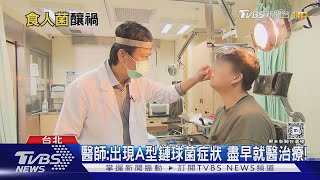 感染「A型鏈球菌」...醫師警告出現「這幾種症狀」...若輕忽 致死風險高!｜十點不一樣20240924 @TVBSNEWS01