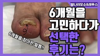 (ENG SUB)6개월동안 고민고민하시다가 관리를 받으신 회원님의 변화는!?