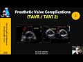 Prosthetic Aortic Valve Complications: TAVR / TAVI 2