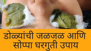 डोळ्यांची जळजळ आणि सोप्पा घरगुती उपाय| Burning sensation of Eye