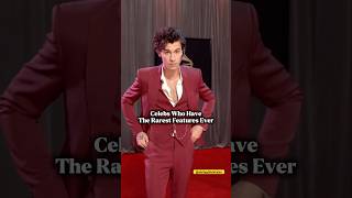 Celebrities Who Have the Rarest Features #celebs