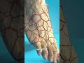 How To Grow Mushrooms On Your Feet 🤔