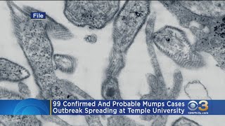 99 Probable, Confirmed Cases Of Mumps In Temple Community