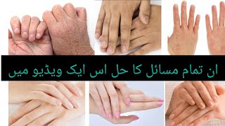 سردیوں میں ہاتھ پاؤں کی سکن کو موئسچرائز رکھنے کا طریقہ/ نرم و ملائم ہاتھ پاؤں/ڈیلی سکن کئیر روٹین/