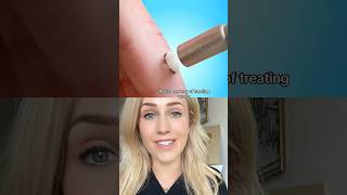Doctor reacts: freezing a wart (🎥 @zackdfilms)