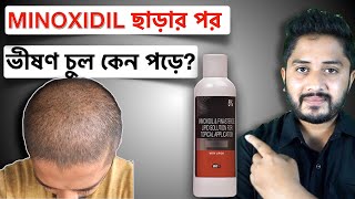 Side Effect of Minoxidil. মিনোক্সিডিল ছাড়ার পর ভীষণ চুল কেন পড়ে?