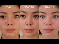 SKINCARE ROUTINE: ZO SKIN HEALTH ONE MONTH RESULTS