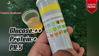 Granular Casts | Amorphous Urate | Yeast Cells | Routine Examination | by YouTube Healthcare