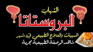 عالج نفسك بنفسك من مرض البروستاتا في شهر واحد بدون علاجات، الجزء الثالث