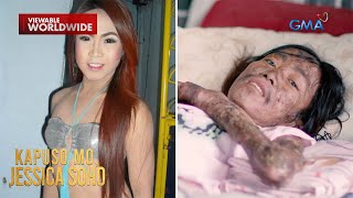 Dating kontesera,baldado na sa higaan dahil sa kanyang misteryosong sakit! | Kapuso Mo, Jessica Soho