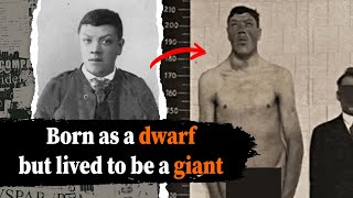 The incredible tale of a man who was born as a dwarf but lived to be a giant.