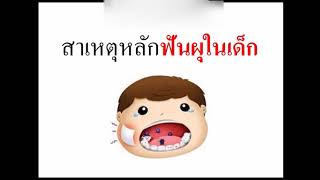 ฟันผุในเด็ก