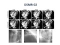 functional and anatomic assessment of coronary artery disease by mri ashraf hamdan