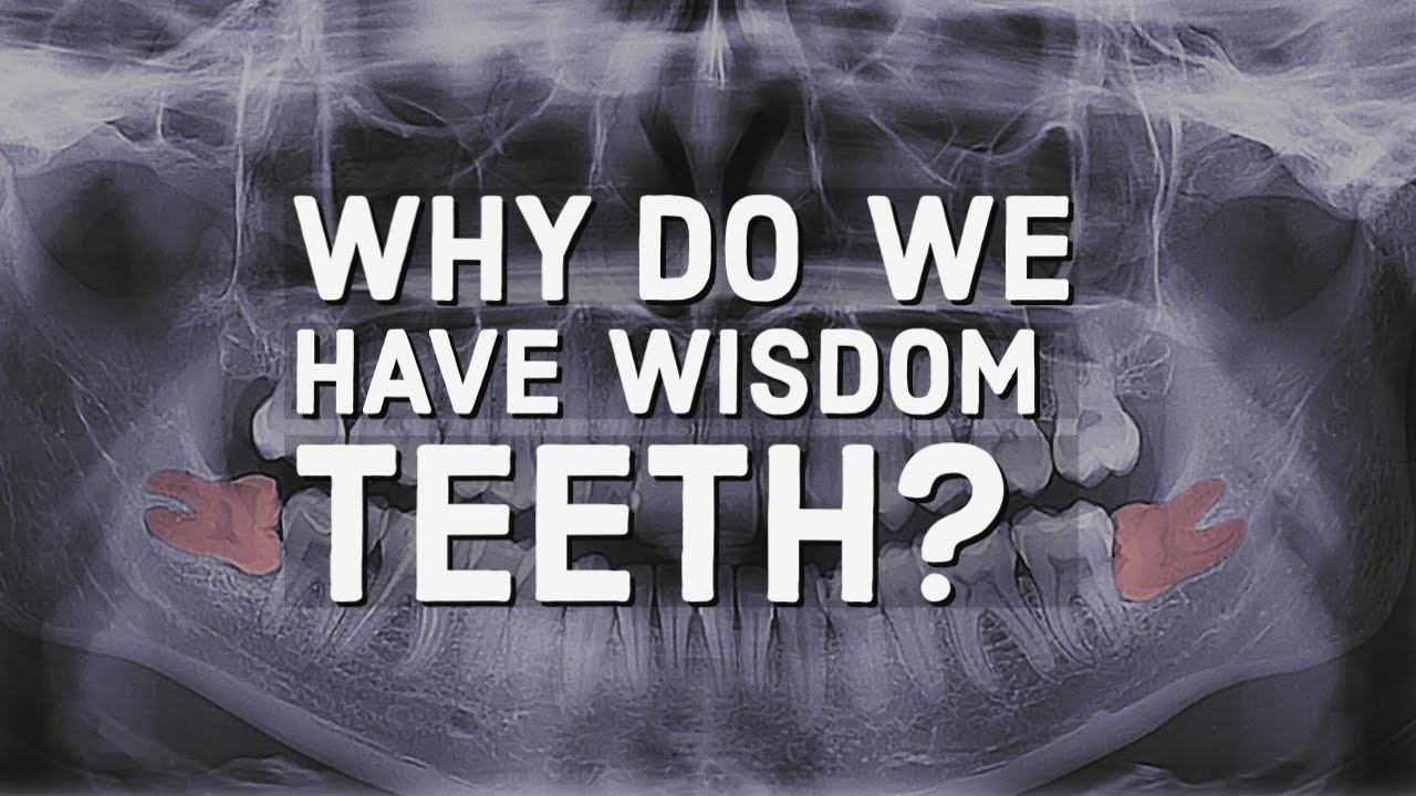 Why Do We Have Wisdom Teeth? - YouTube