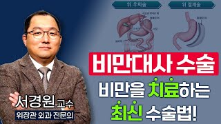 만병의 근원 비만! 스스로 해결하기 어렵다면 수술을 통해 치료할수 있습니다 / 부산mbc TV닥터인사이드 221024 방송