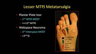 Forefoot and Midfoot: Sources of Pain