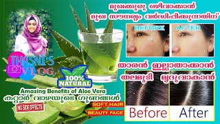 BENEFITS OF ALOE VERA | കറ്റാർ വാഴയുടെ ഗുണങ്ങൾ | മുഖ സൗന്ദര്യത്തിനും താരൻ നീക്കംചെയ്യലിനും