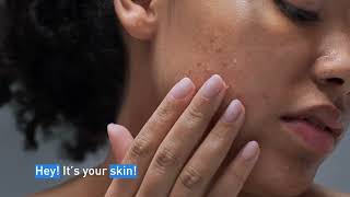 Clear Acne and Prevent New Breakouts │ CeraVe Skincare