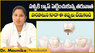 క్యాప్ తర్వాత ఈ జాగ్రత్తలు తీసుకోండి | Precautions After Teeth Capping | Eledent Dental Hospitals