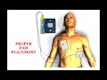 claire aed pad placement adult