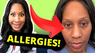 SEASONAL ALLERGY SIGNS YOU SHOULD RECOGNIZE! A Doctor Explains
