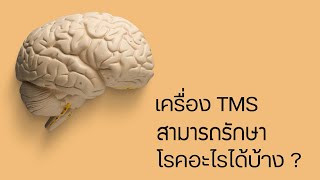 เครื่อง TMS สามารถรักษาโรคอะไรได้บ้าง? (Part2)