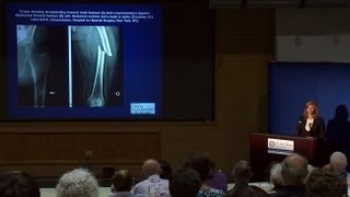 Osteoporosis Update 2013 - Research on Aging