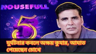 দুর্ঘটনার কবলে অক্ষয় কুমার, আঘাত পেয়েছেন চোখে AKSHAY ACCIDENT STAR 9