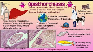 Opisthorchiasis parasitic infection caused by liver flukes Opisthorchis viverrini Or felineus