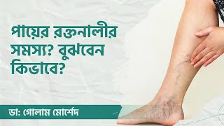 পায়ের রক্তনালী ব্লক হলে করনীয় কি?  by Dr. Golam Morshed FCPS, MRCP UK. Medicine & Heart Specialist