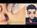 Process of Removing Blackheads inEars with Professional Techniques #satisfying#blackheads#subscribe