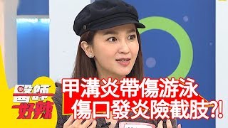 甲溝炎帶傷游泳，傷口發炎險截肢？！【醫師好辣】20200211 part3 EP891 李偉浩 陳榮堅